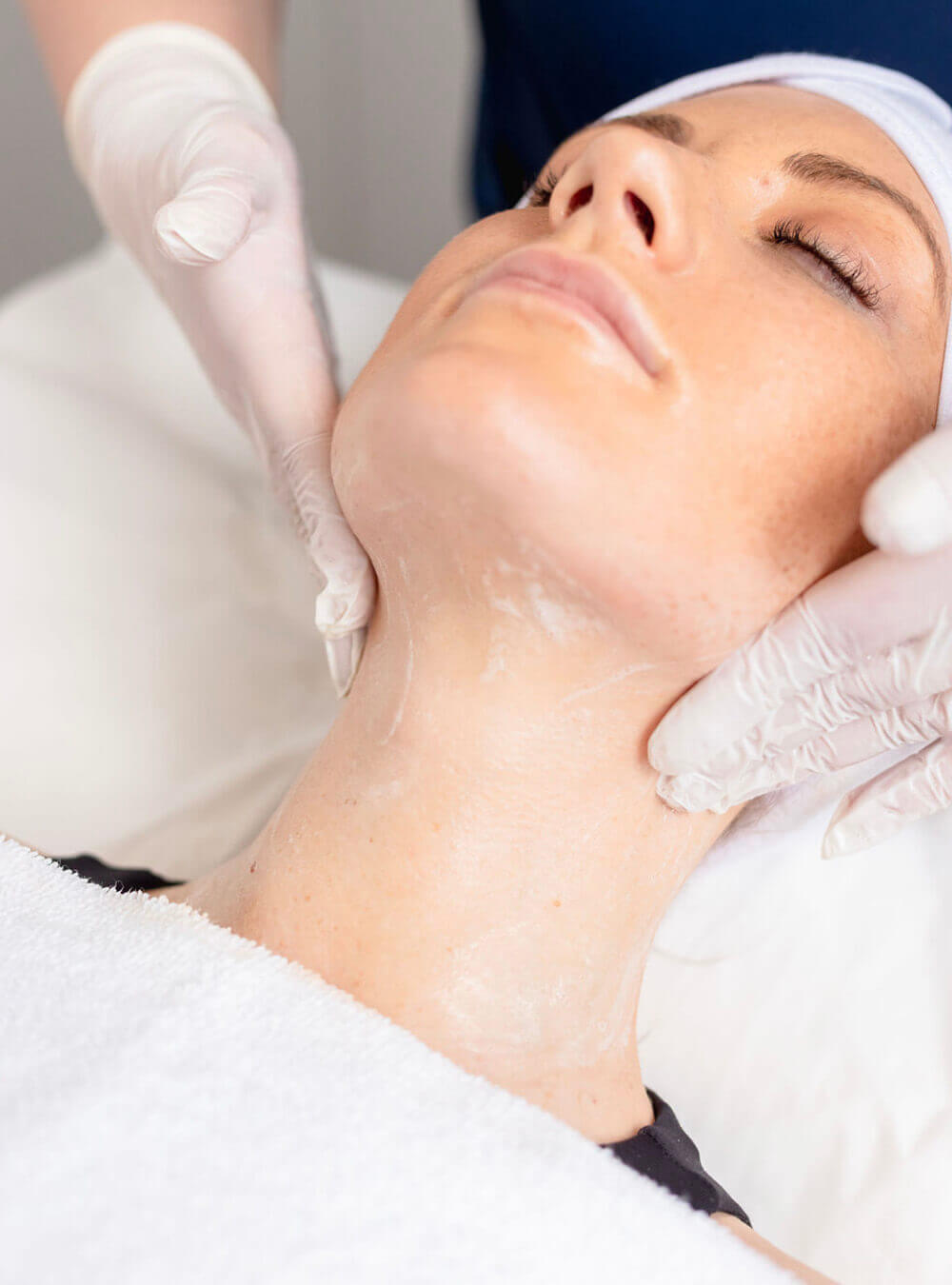 Frequently Asked Questions: Non-Surgical Facelift