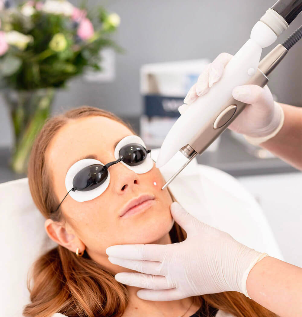 Female face at Laser Hair Removal