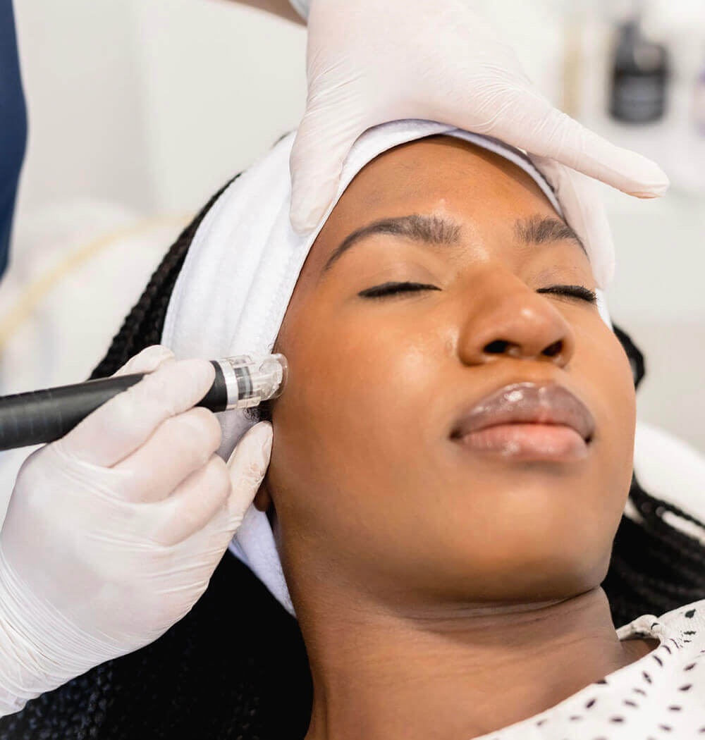 Female patient face at Silhouette Soft Threads treatment