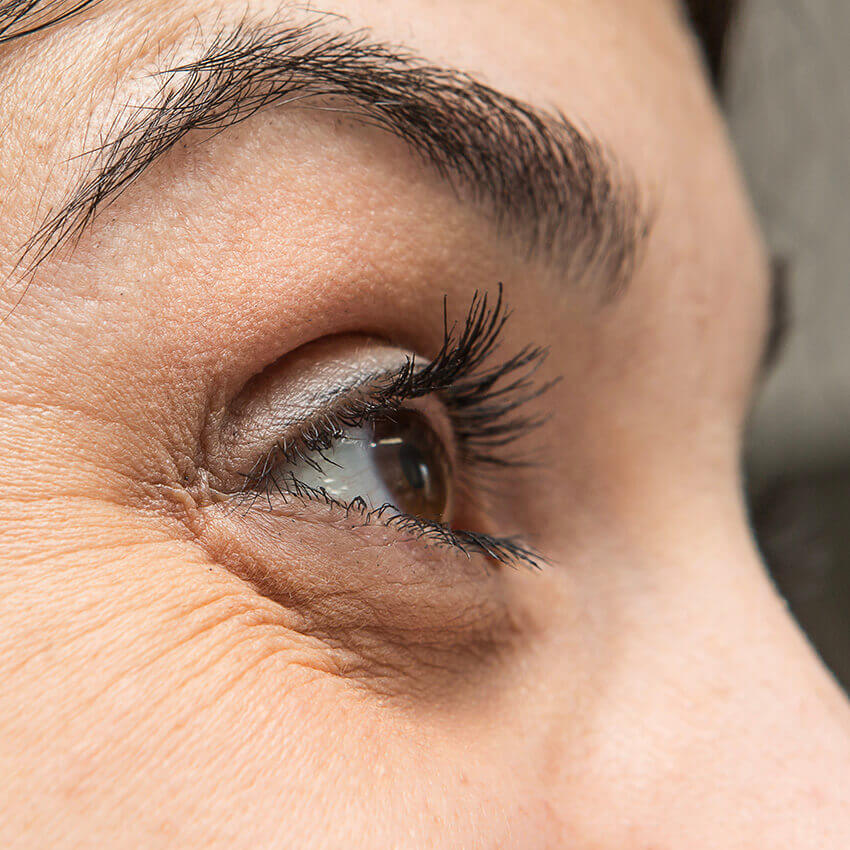 Female face, Dark Circles