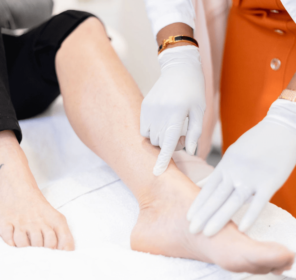 Patient leg at Sclerotherapy treatment