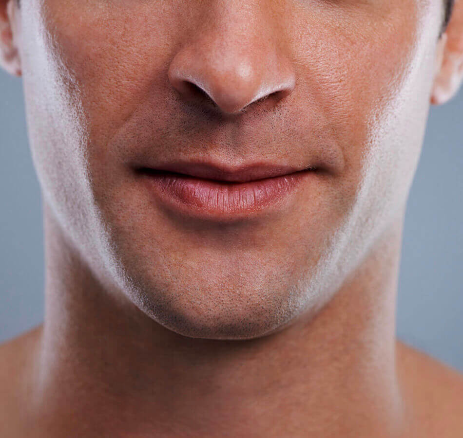 Masseter Muscle Reduction Treatment (male face)