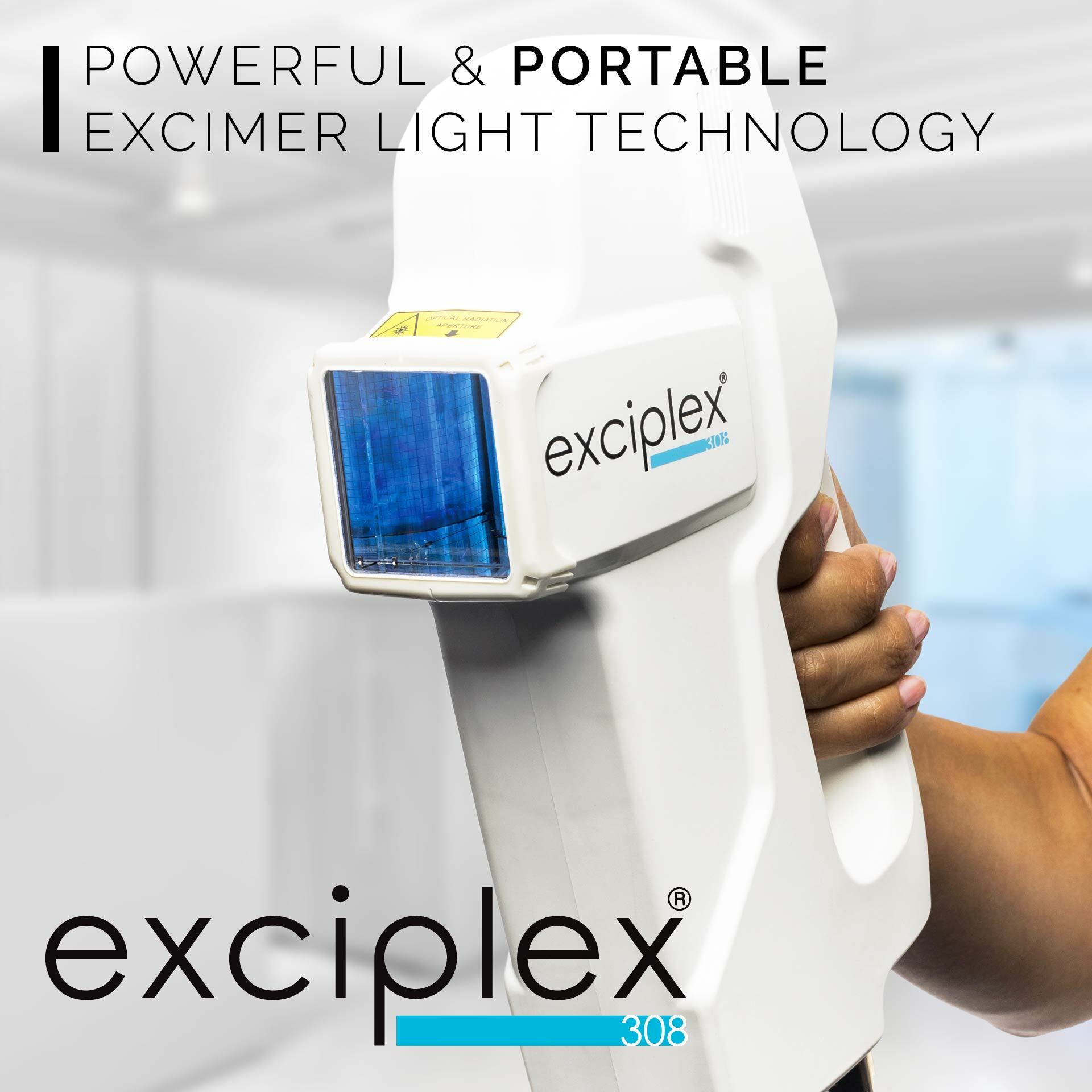 alopecia-areata-treatments-exciplex-london-maida-vale