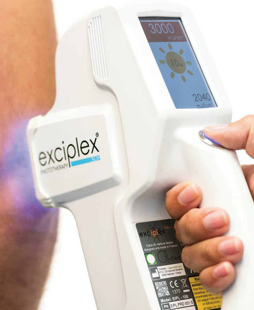 Exciplex Device for Atopic Dermatitis