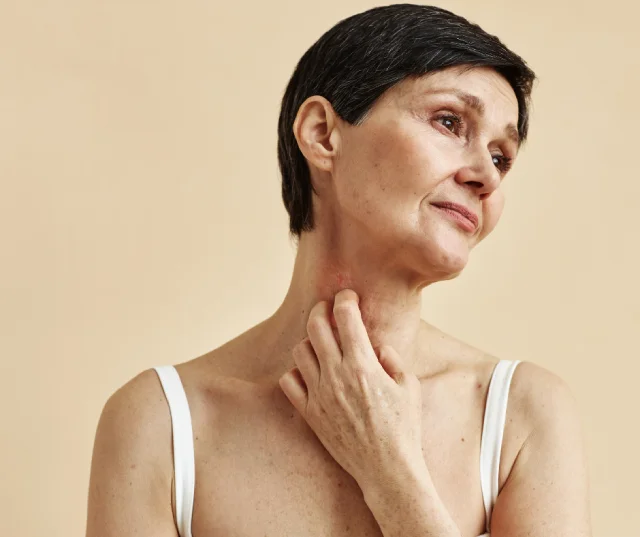 Mycosis Fungoides: woman struggling scatching her neck area